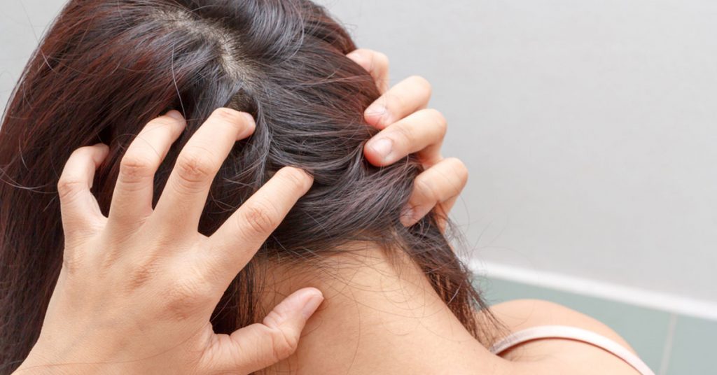 قشرة الشعر الناتجة عن بعض الأمراض الجلدية