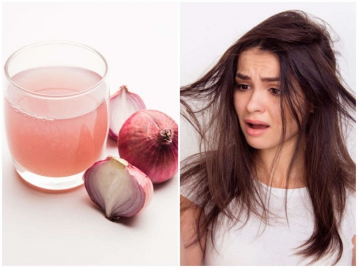 عصير البصل لعلاج اطراف الشعر